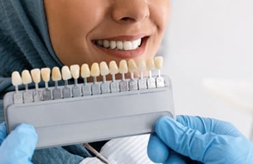 أهمية تجميل الأسنان
