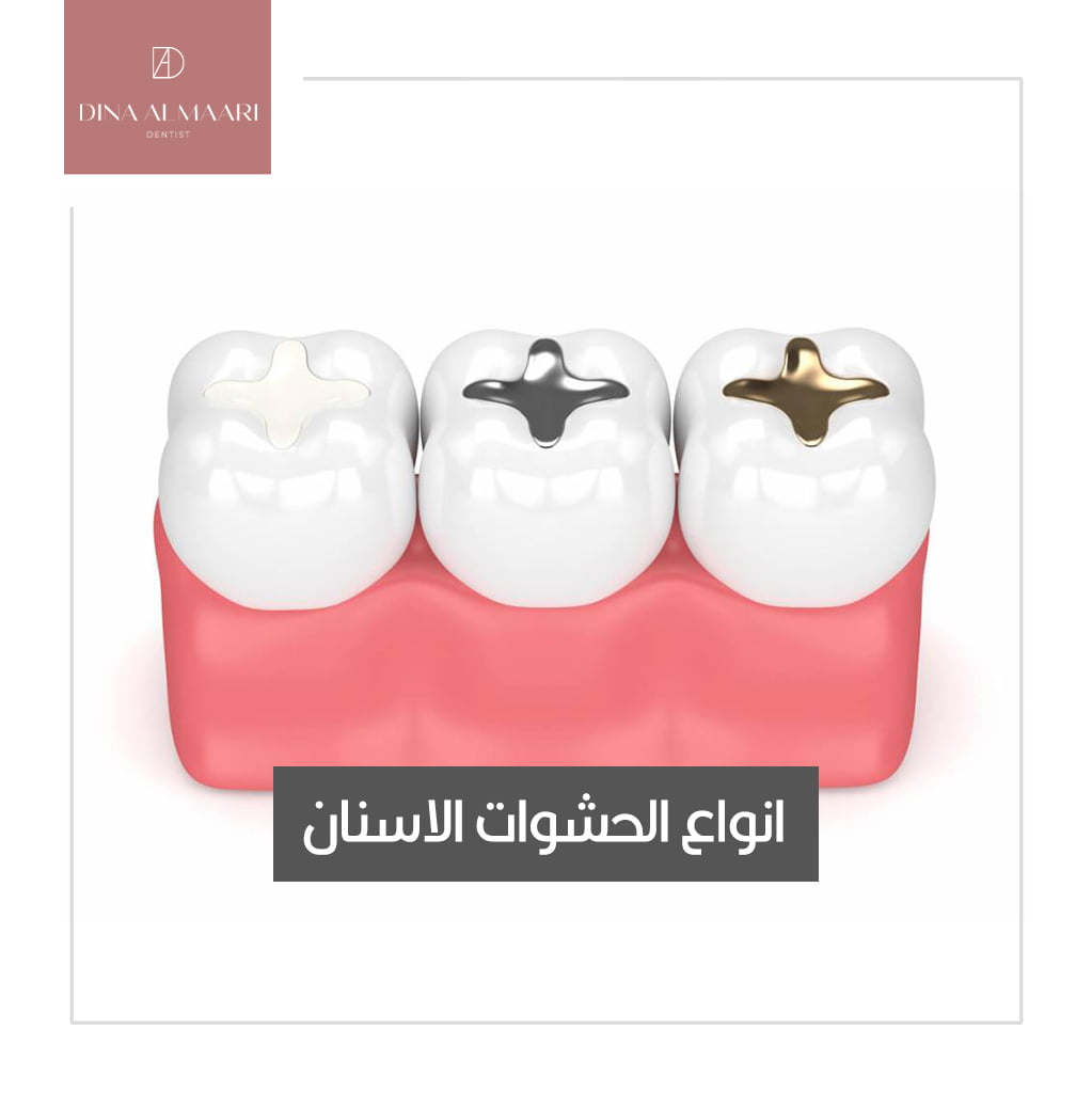 افضل عيادة اسنان في الرياض