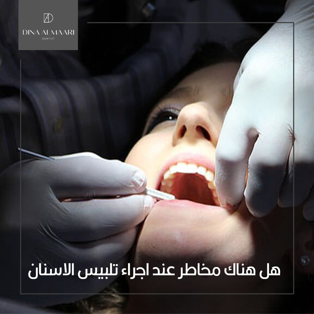 مخاطر تلبيس الاسنان
